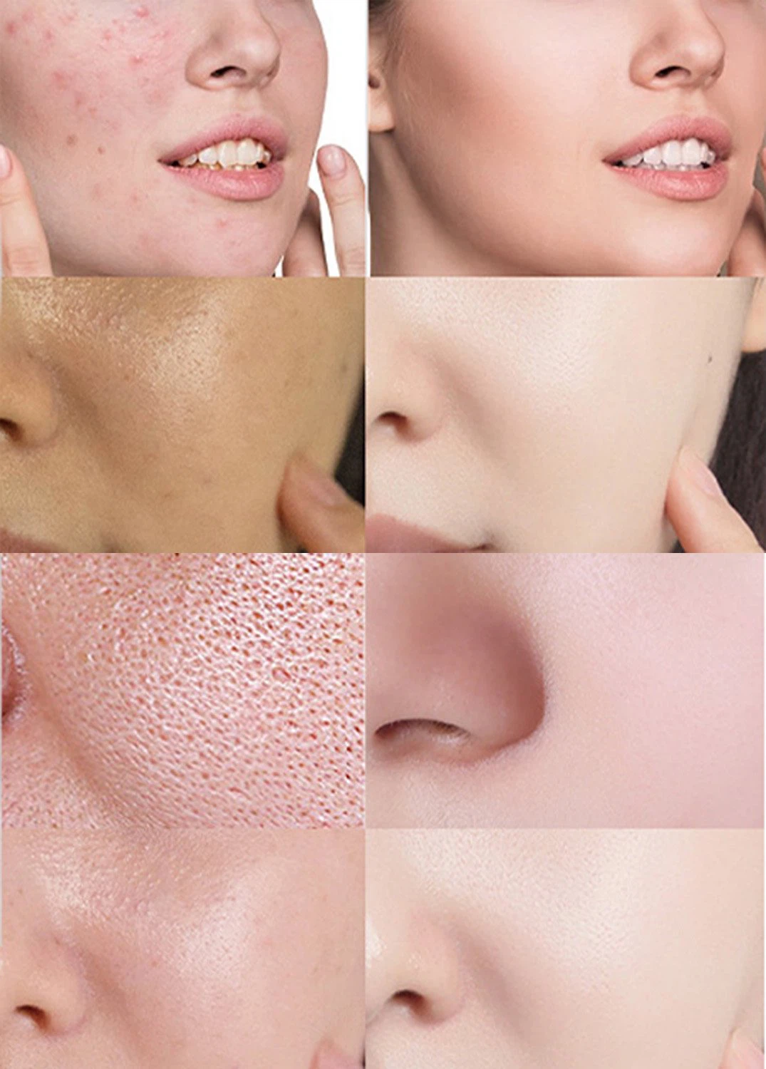 Salicylic acid 6